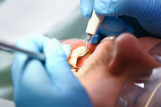 Best Emergency Dental Care for Abscessed Tooth in Dripping Springs, TX