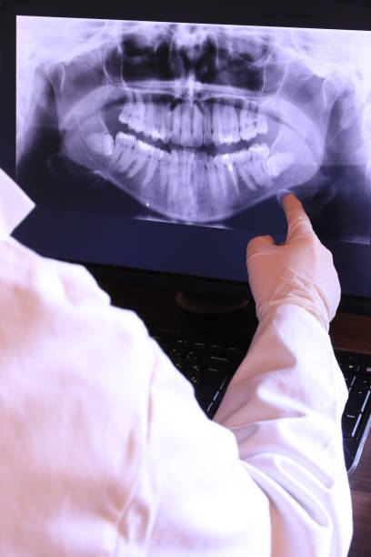Best Emergency Dentist for Lost Fillings or Crowns in Dripping Springs, TX