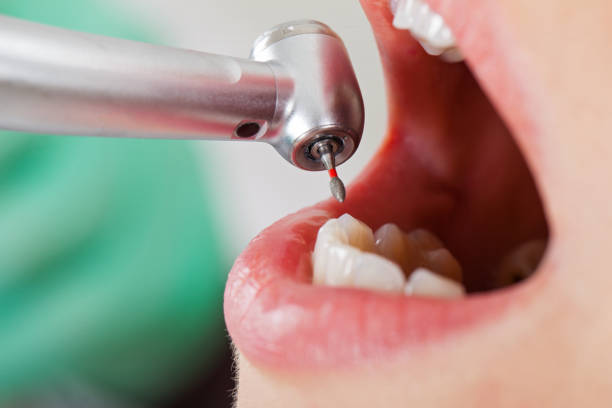 Best Mobile Emergency Dentist in Dripping Springs, TX